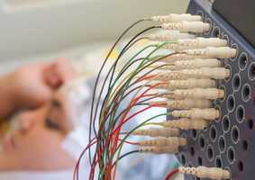 electrodes connected to medical equipment
